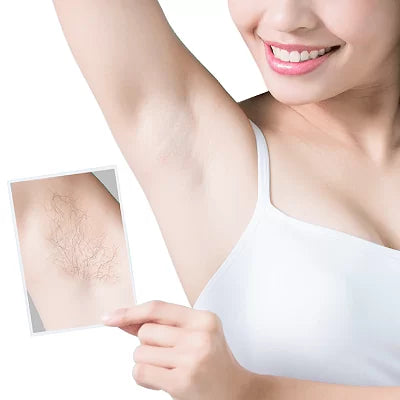 Unlock Smooth Skin Secrets with IPL Hair Removal: Your Ultimate Guide!