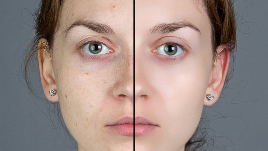 Unlock the Secrets of Smooth Skin: 7 Essential Tips for Safe & Effective Hair Removal