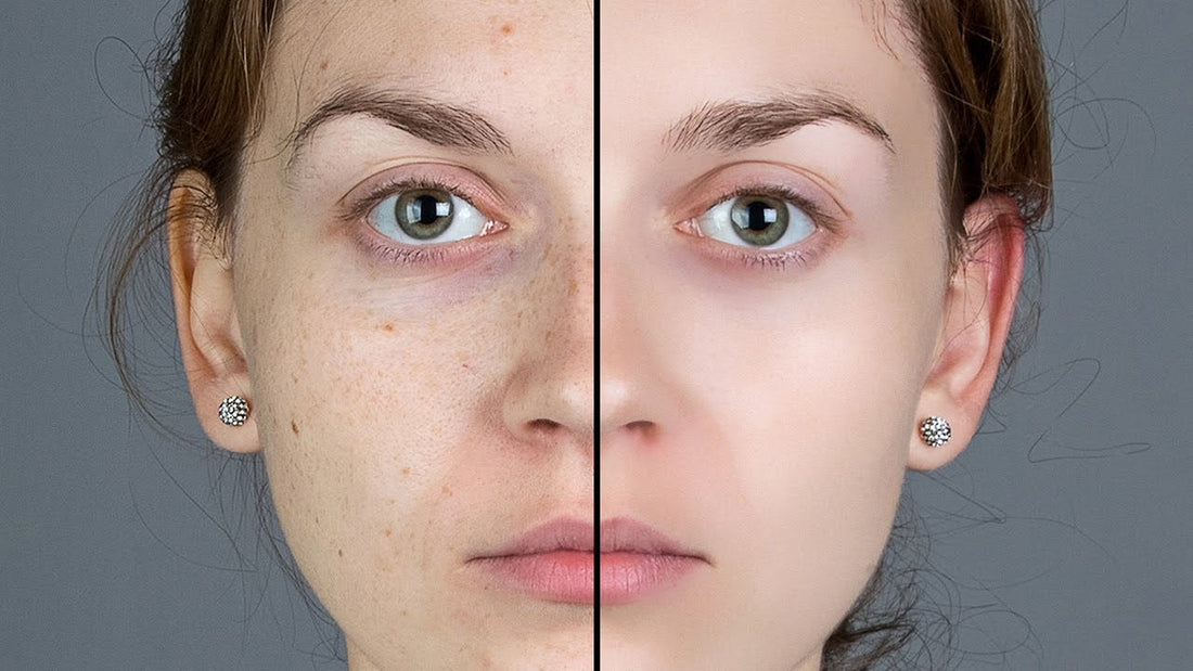 Unlock the Secrets of Smooth Skin: 7 Essential Tips for Safe & Effective Hair Removal